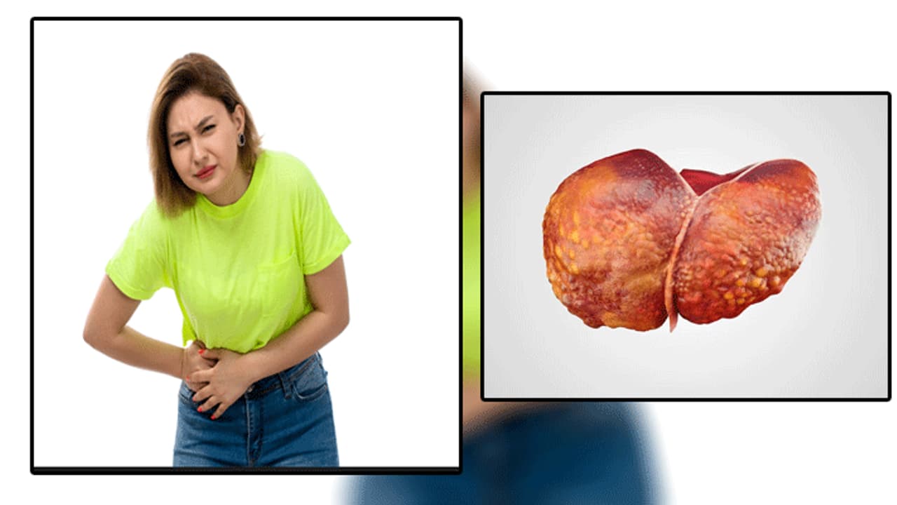 fatty liver fatty liver