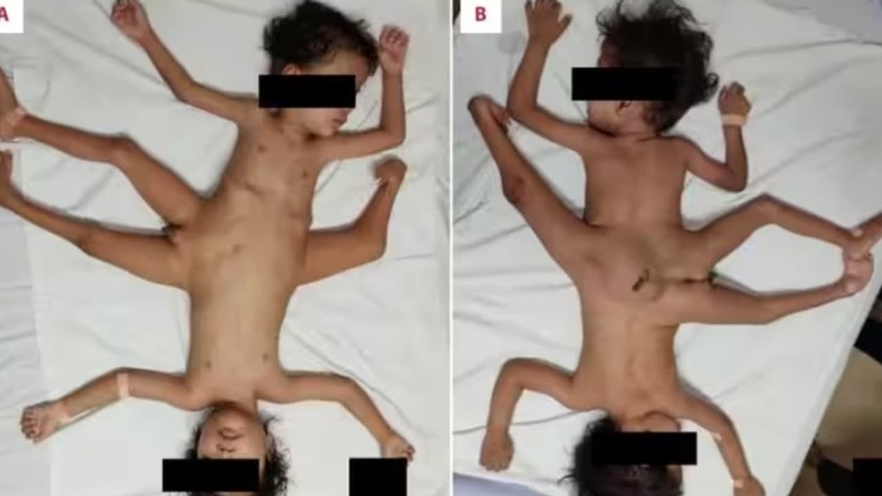 twins .jpg twins .jpg