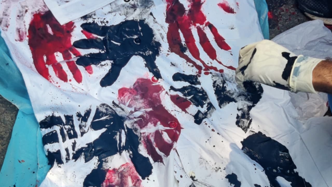 Doctors protest delhi Doctors protest delhi