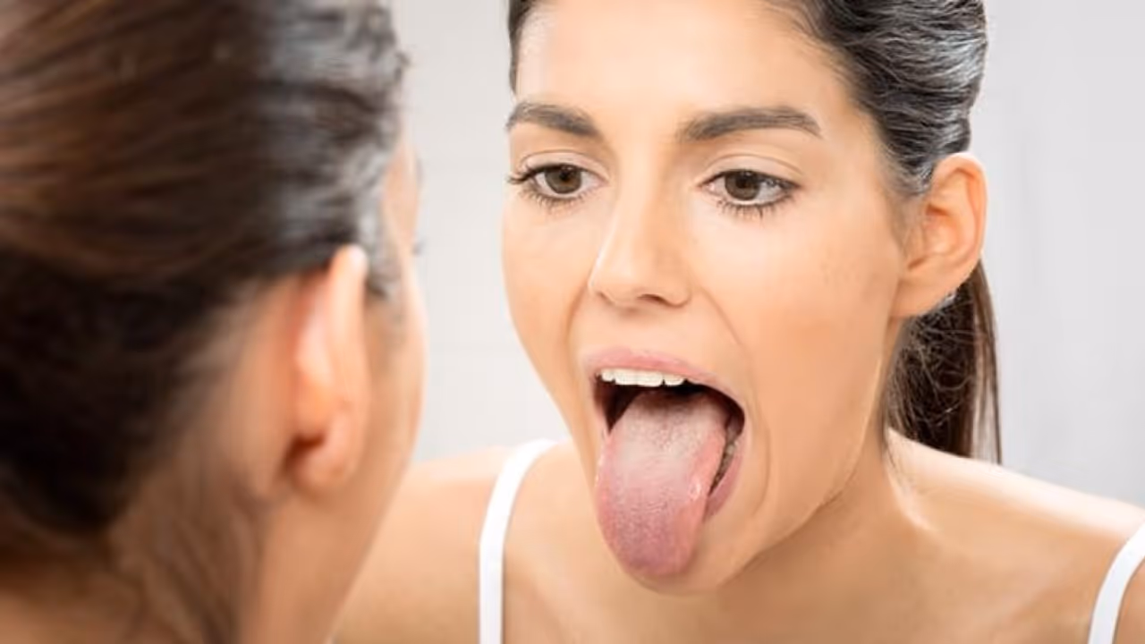 tongue cancer 7 symptoms