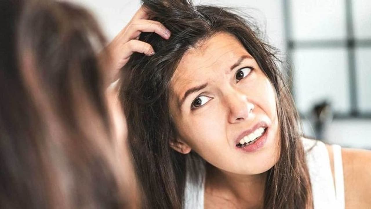 Say goodbye to dandruff with these natural tips and tricks to keep those locks long, shiny