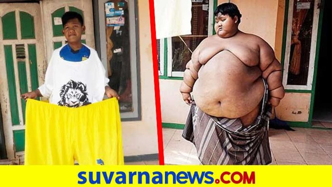 107 ಕೆಜಿ ತೂಕ ಇಳಿಸಿಕೊಂಡ ಬಾಲಕನ ಫಿಟ್ನೆಸ್‌ ಜರ್ನಿ ! | how 190 worlds fattest ...