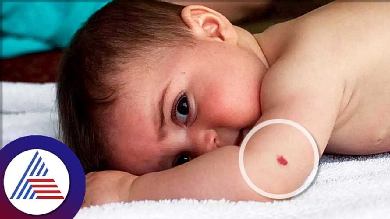 ದೇಹದ ಮೇಲಿನ ಜನ್ಮ ಗುರುತು, ನಿಮ್ಮ ಭವಿಷ್ಯ ಹೇಳುತ್ತೆ! | Birthmark On Body ...