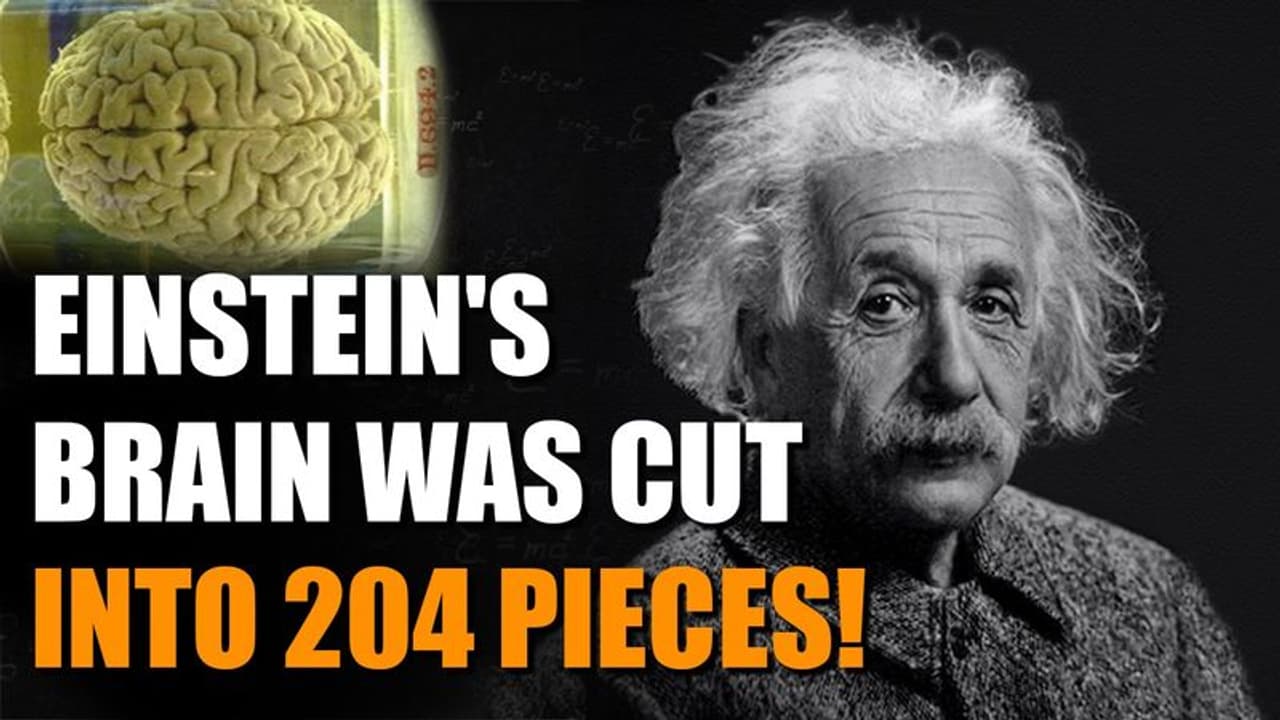 Did you know? Albert Einstein's brain was stolen, cut into 240 pieces ...