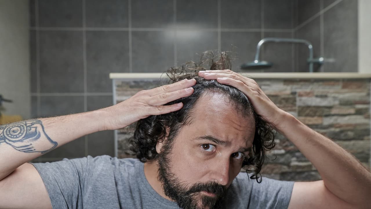 Sweet Stevia Compound Boosts Hair Growth by Enhancing Minoxidil Absorption