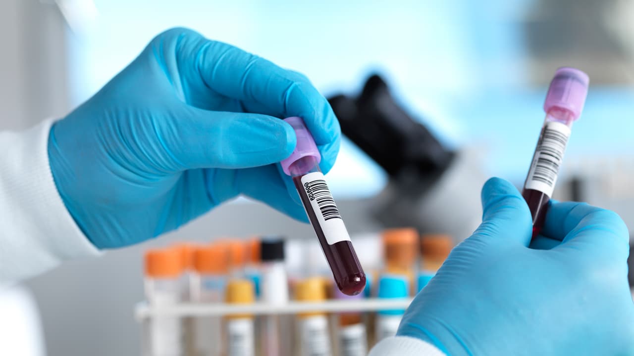 Scientists unveil HPV-DeepSeek, a test that spots cancer 10 years early