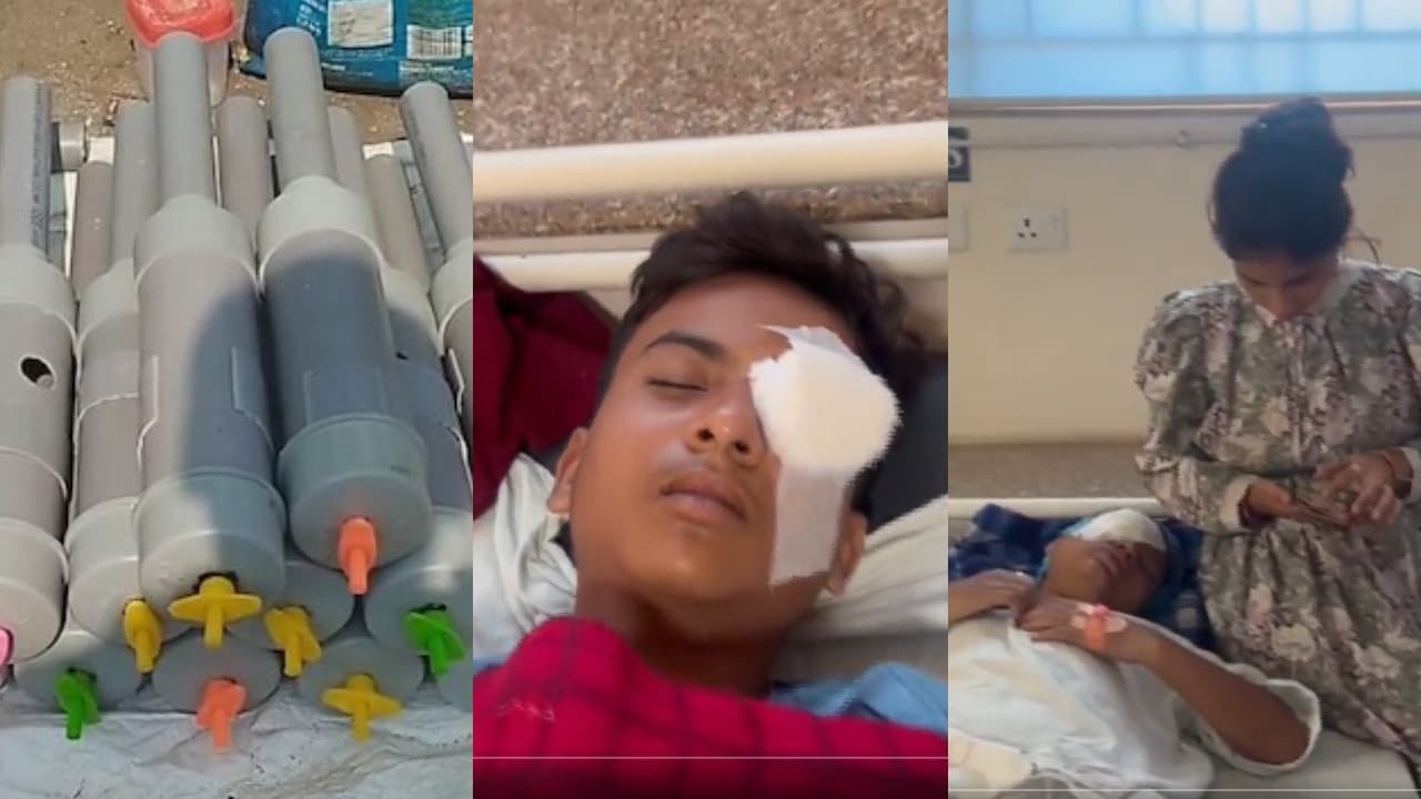 Toy Gun Injuries Carbide Gun caused severe eye injuries| കാർബൈഡ് ഗൺ അപകടം: ദീപാവലിക്ക് ...