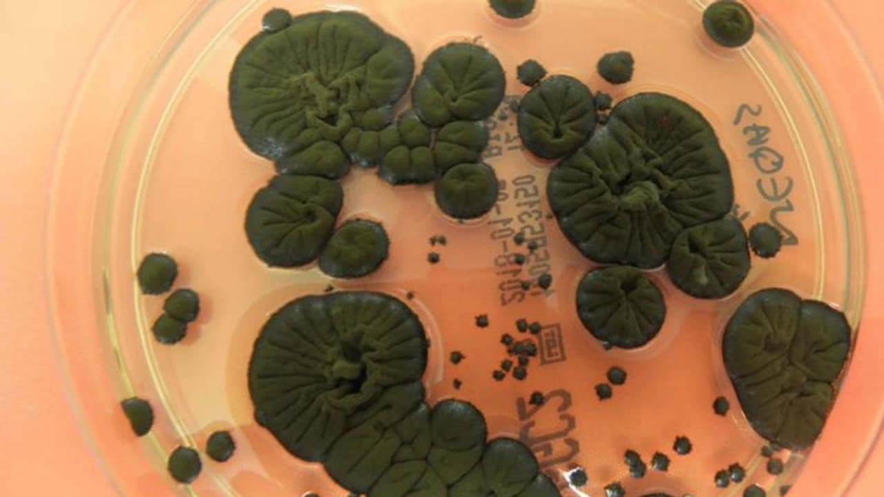 Chernobyl’s Radiation-Eating Life Could Transform Space Travel and Cancer Research