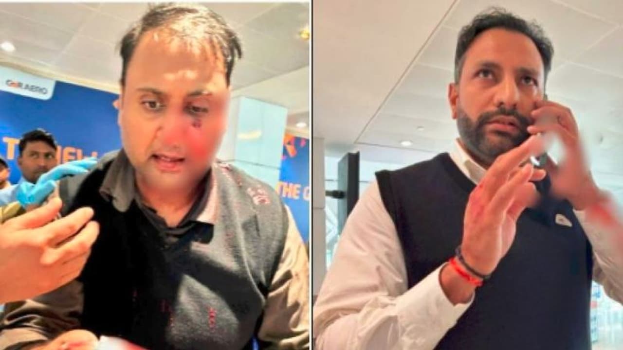 ಪ್ಯಾಸೆಂಜರ್ಗೆ ಮೂಗಿನ ಮೂಳೆ ಮುರಿಯುವಂತೆ ಹೊಡೆದ ಏರ್ ಇಂಡಿಯಾ ಪೈಲಟ್ ವಿರುದ್ಧ ಎಫ್ಐಆರ್ | Fir Against Air India Pilot Virendra Sejwal Who Breaking Passenger Nose ಪ್ಯಾಸೆಂಜರ್ಗೆ ಮೂಗಿನ ಮೂಳೆ ಮುರಿಯುವಂತೆ ಹೊಡೆದ ಏರ್ ಇಂಡಿಯಾ ಪೈಲಟ್ ವಿರುದ್ಧ ಎಫ್ಐಆರ್ | Fir Against Air India Pilot Virendra Sejwal Who Breaking Passenger Nose