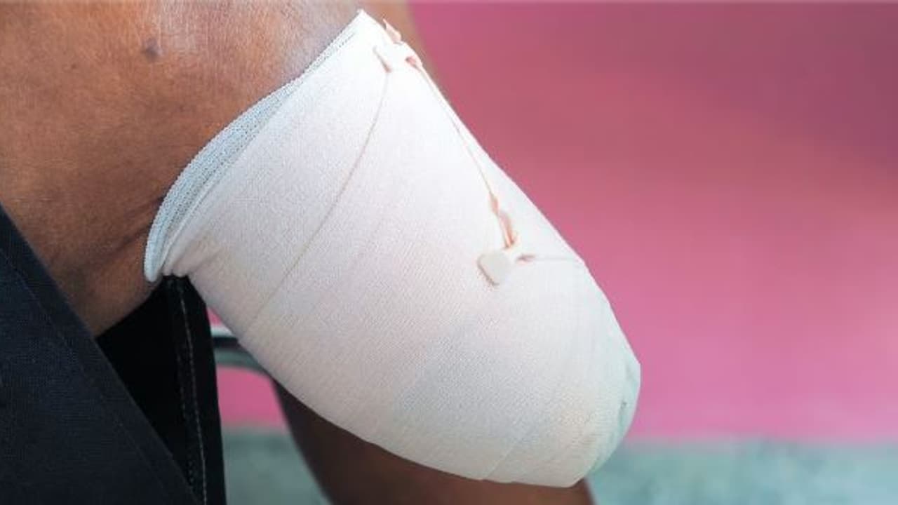 ಅಂಗವಿಕಲರ ಕೋಟಾದಡಿ ಎಂಬಿಬಿಎಸ್ ಸೀಟು ಪಡೆಯಲು ತನ್ನದೇ ಕಾಲಿನ ಬೆರಳಗಳನ್ನು ಕತ್ತರಿಸಿದ ಯುವಕ | Up News Youth Cut His Own Fingers To Get Medical Admission Under Disabled Quota ಅಂಗವಿಕಲರ ಕೋಟಾದಡಿ ಎಂಬಿಬಿಎಸ್ ಸೀಟು ಪಡೆಯಲು ತನ್ನದೇ ಕಾಲಿನ ಬೆರಳಗಳನ್ನು ಕತ್ತರಿಸಿದ ಯುವಕ | Up News Youth Cut His Own Fingers To Get Medical Admission Under Disabled Quota