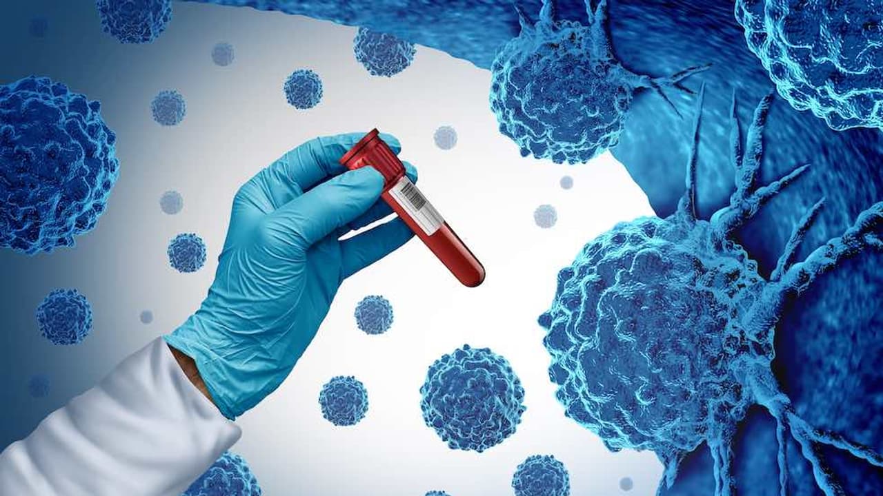 Cancer Treatment: কেমো নয়, এবার মাইনাস ১৯০ ডিগ্রিতে জমে মরবে ক্যানসার ...
