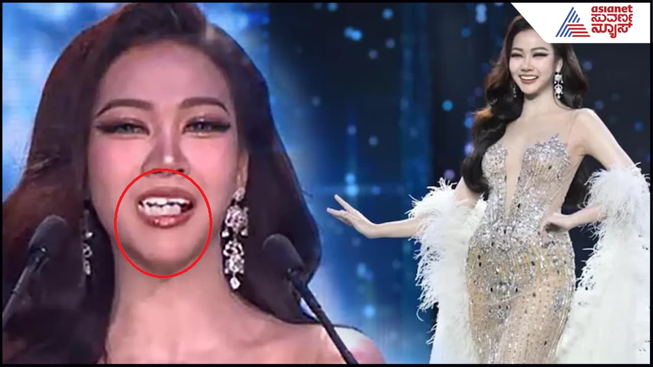 ಬ್ಯೂಟಿ ಸ್ಪರ್ಧೆಯಲ್ಲಿ ಹೂನಗೆ ಬೀರಿದ ಸುಂದ್ರಿಯ ಹಲ್ಲು ಸೆಟ್ಟೇ ಬಿದ್ದೋಯ್ತು! ವಿಡಿಯೋ ವೈರಲ್ ಆಗೋಯ್ತು ಬ್ಯೂಟಿ ಸ್ಪರ್ಧೆಯಲ್ಲಿ ಹೂನಗೆ ಬೀರಿದ ಸುಂದ್ರಿಯ ಹಲ್ಲು ಸೆಟ್ಟೇ ಬಿದ್ದೋಯ್ತು! ವಿಡಿಯೋ ವೈರಲ್ ಆಗೋಯ್ತು