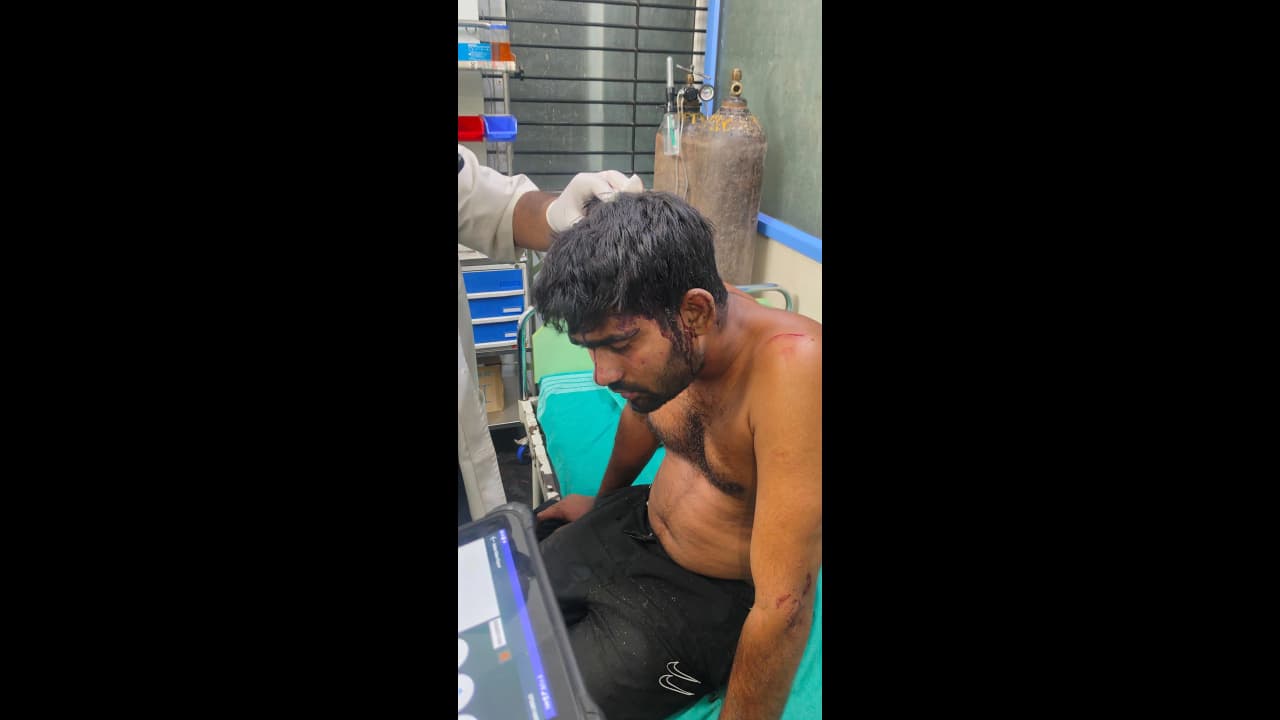 ಕಾರಿಗೆ ಲಾರಿ ಡಿಕ್ಕಿಯಾಗಿ ಕುರುಬರಹಳ್ಳಿ ಸಮೀಪ ಭೀಕರ ಅವಘಡ : ಚಾಲಕ ಸಜೀವ ದಹನ-ಮನೆಗೆ ಆಸರೆಯಾಗಿದ್ದ ದಾಸ್ | Driver Burnt Alive In Horrific Crash After Lorry Rams Car ಕಾರಿಗೆ ಲಾರಿ ಡಿಕ್ಕಿಯಾಗಿ ಕುರುಬರಹಳ್ಳಿ ಸಮೀಪ ಭೀಕರ ಅವಘಡ : ಚಾಲಕ ಸಜೀವ ದಹನ-ಮನೆಗೆ ಆಸರೆಯಾಗಿದ್ದ ದಾಸ್ | Driver Burnt Alive In Horrific Crash After Lorry Rams Car