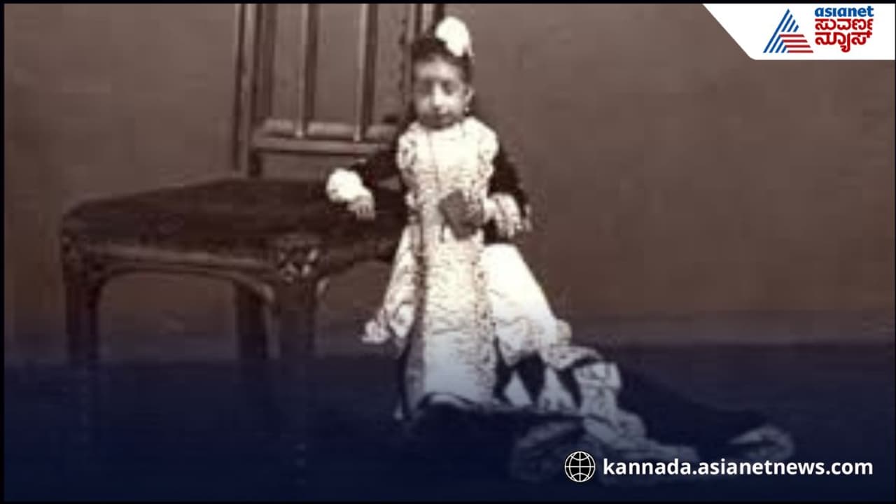 World lightest person : 17 ವರ್ಷದ ಈ ಹುಡುಗಿನಾ ಒಂದೇ ಕೈನಲ್ಲಿ ಎತ್ಬಹುದು, ನವಜಾಸ ಶಿಶುಗಿಂತ ಹಗುರ ಈಕೆ | World Lightest Person Lucia Zarate Guinness World Record Hight Weight Age World lightest person : 17 ವರ್ಷದ ಈ ಹುಡುಗಿನಾ ಒಂದೇ ಕೈನಲ್ಲಿ ಎತ್ಬಹುದು, ನವಜಾಸ ಶಿಶುಗಿಂತ ಹಗುರ ಈಕೆ | World Lightest Person Lucia Zarate Guinness World Record Hight Weight Age