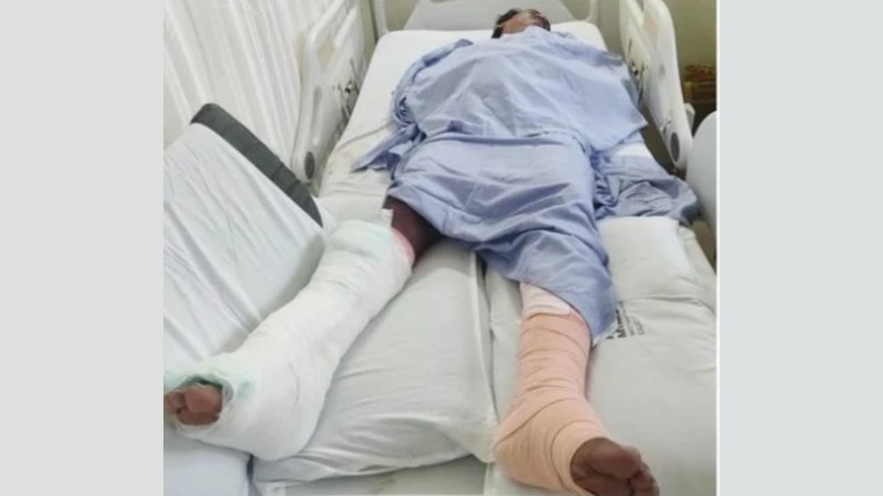 റോഡരികില്‍ അട്ടിയിട്ട വൈദ്യുതി തൂണുകള്‍ മറിഞ്ഞുവീണു,കാലിലെ എല്ലുകൾ പൊട്ടി, മാംസം അടർന്നു, അധ്യാപകന് ഗുരുതര പരിക്ക് - Asianet News Malayalam