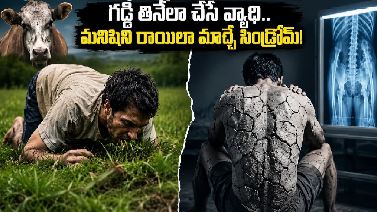 గడ్డి తినేలా చేసే వ్యాధి ఒకటి, శరీరాన్ని రాయిలా మార్చే రోగం మరొకటి.. ఈ రెండూ వస్తే చికిత్సే
