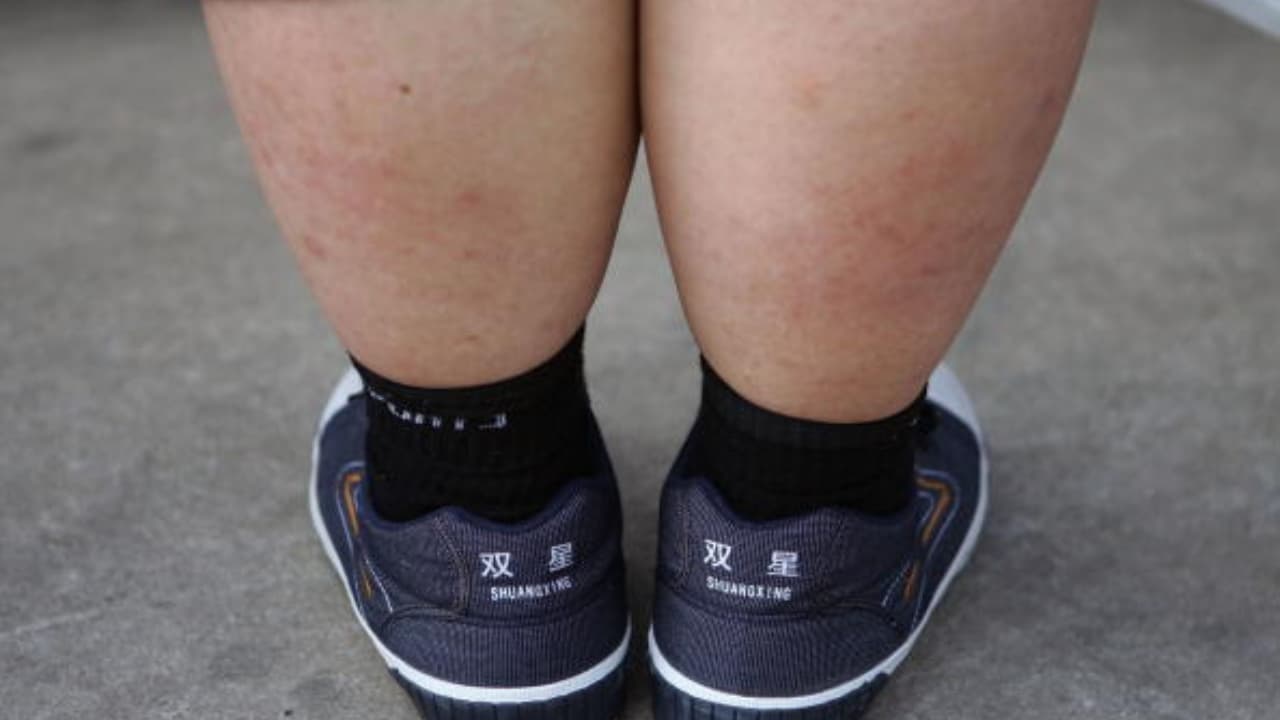 w-1280,h-720,format-jpg,imgid-01kw94t3991jm5d7xvvq2jhyhq,imgname-obesity-in-children-1782718467369.jpg
