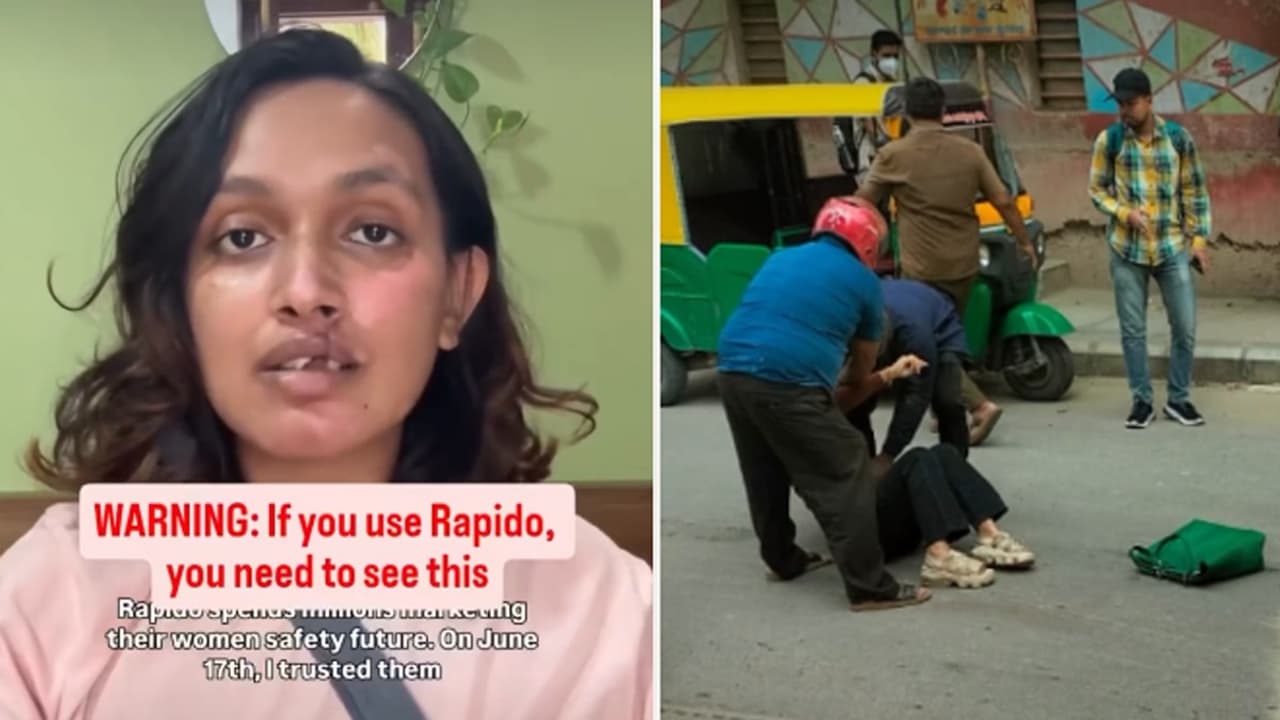 Bengaluru Taxi Horror: Woman Sues Rapido After Bike Crash Leaves Her With Rs 20 Lakh Hospital Bill