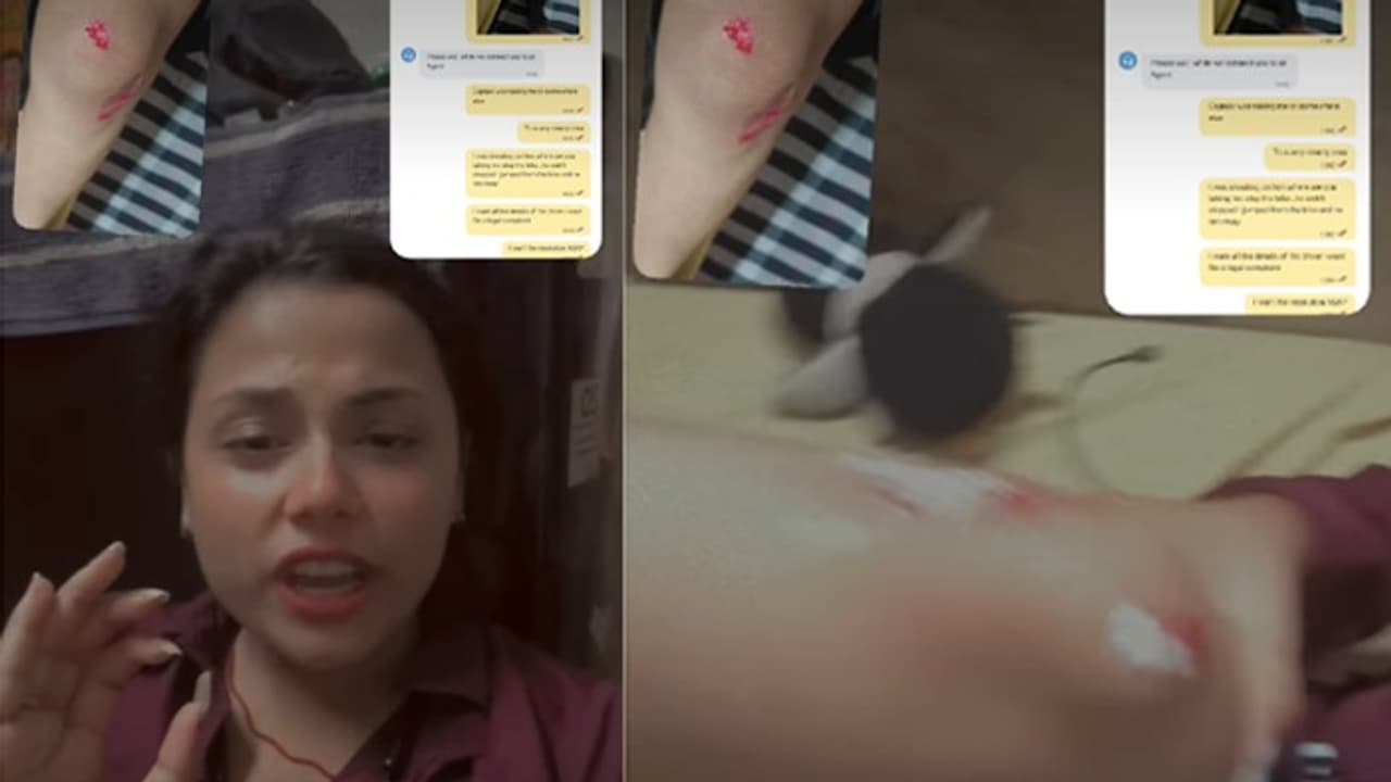 Delhi Woman Injured After Jumping From Moving Rapido Bike Over Safety Fears