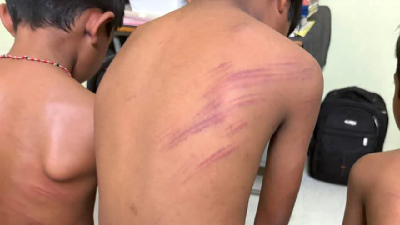 Karnataka: Guest Teacher Allegedly Beats 3 Students In Shivamogga Over Low Marks