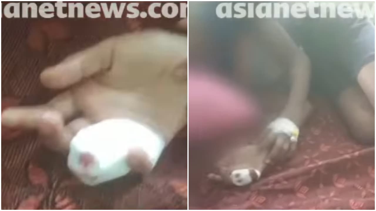 w-1280,h-720,format-jpg,imgid-01m2yss354657as55wh1xaatf5,imgname-thiruvananthapuram-stray-dog-attack-1789887548579.jpg
