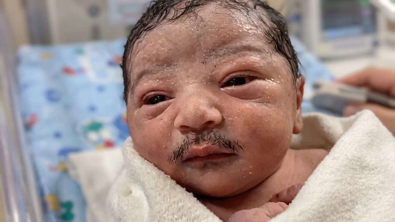 Baby With Thick Mustache: பிறந்த குழந்தைக்கு அடர்த்தியான மீசையா? இணையத்தை கலக்கும் ஈக்வடார் வீடியோ