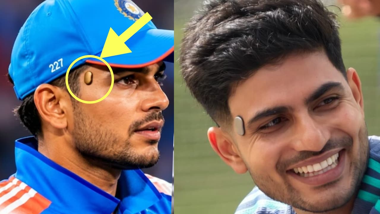 ಅಯ್ಯೋ, ಗಿಲ್ ಕೆನ್ನೆಗೆ ಏನಾಯ್ತು.. ಹಣೆಗೆ ಅಂಟಿಸಿದ ಸಾಧನ ಕಂಡು ಗಾಬರಿಯಾದ ಫ್ಯಾನ್ಸ್, ಏನದು?