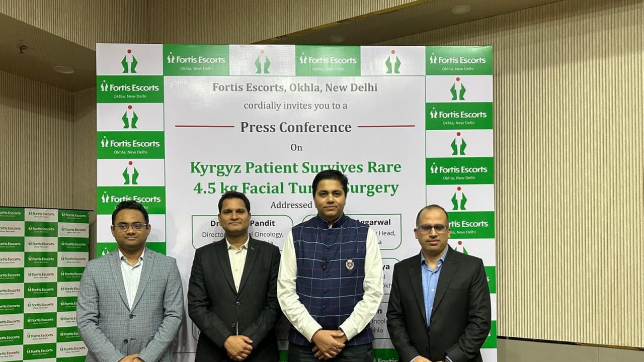 Kyrgyz man with 4.5kg facial tumour gets life-saving surgery in Delhi
