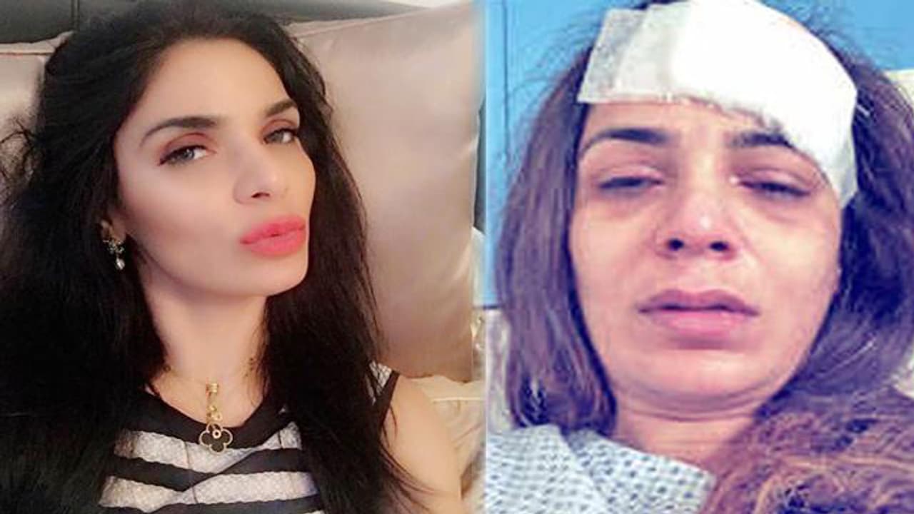 ‘కోహ్లీ నన్ను చావకొట్టాడు’ ‘కోహ్లీ నన్ను చావకొట్టాడు’