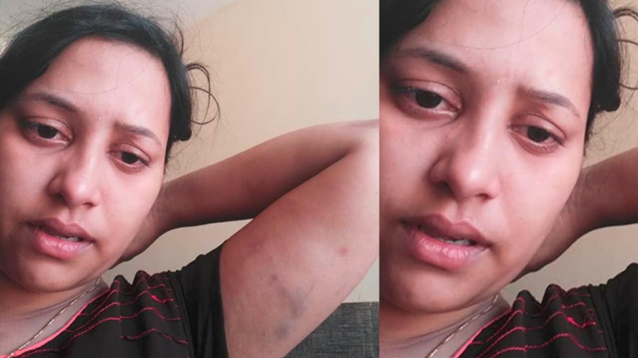 భార్యపై కృష్ణా జిల్లా టిడిపి యూత్ లీడర్ దాష్టికం భార్యపై కృష్ణా జిల్లా టిడిపి యూత్ లీడర్ దాష్టికం