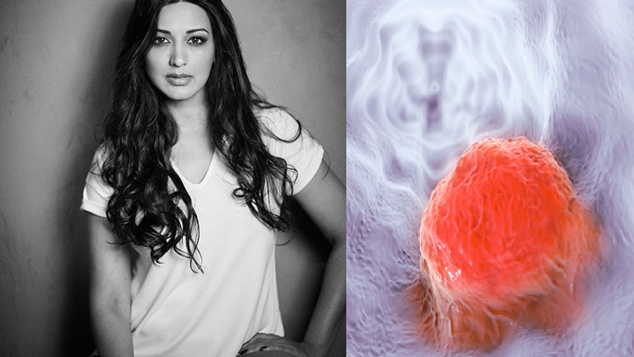 Actress Sonali Bendre diagnosed with cancer: What is high grade cancer? Actress Sonali Bendre diagnosed with cancer: What is high grade cancer?