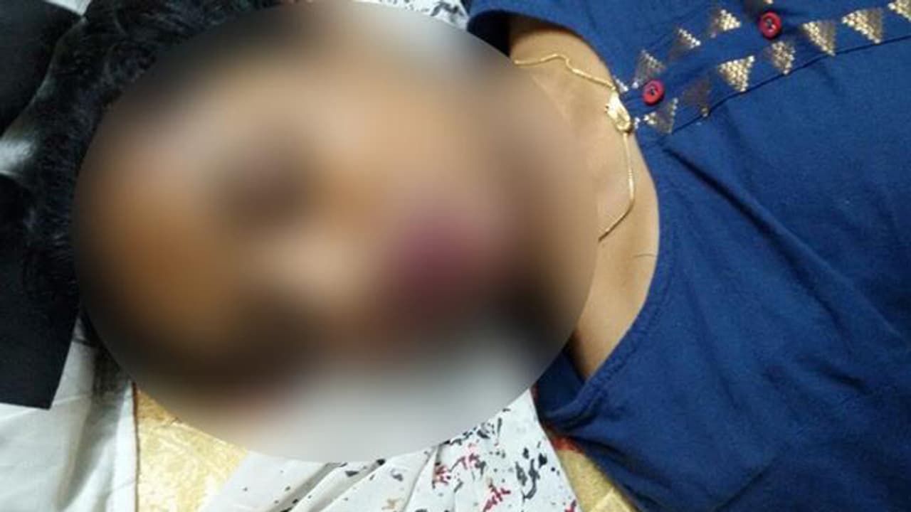 తల్లిదండ్రులపై కోపంతో యువతి ఆత్మహత్య తల్లిదండ్రులపై కోపంతో యువతి ఆత్మహత్య