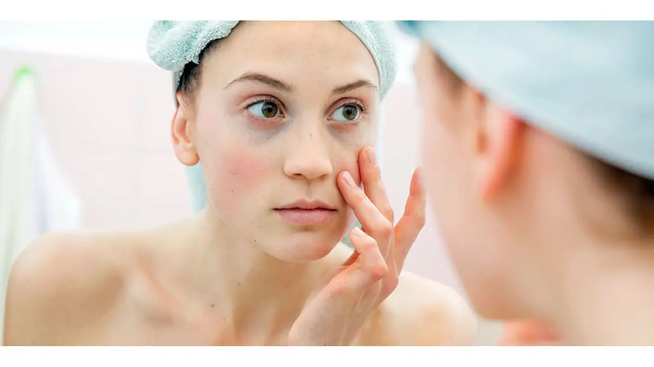 <p>Dark circles are one of the banes of one’s existence and can make one rather conscious.&nbsp;</p>
