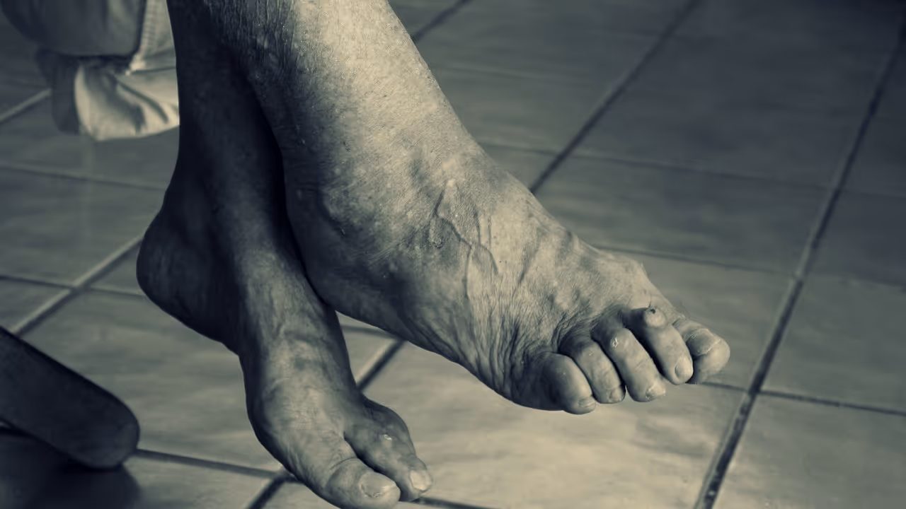 Interact with people more to overcome dementia, says study Interact with people more to overcome dementia, says study