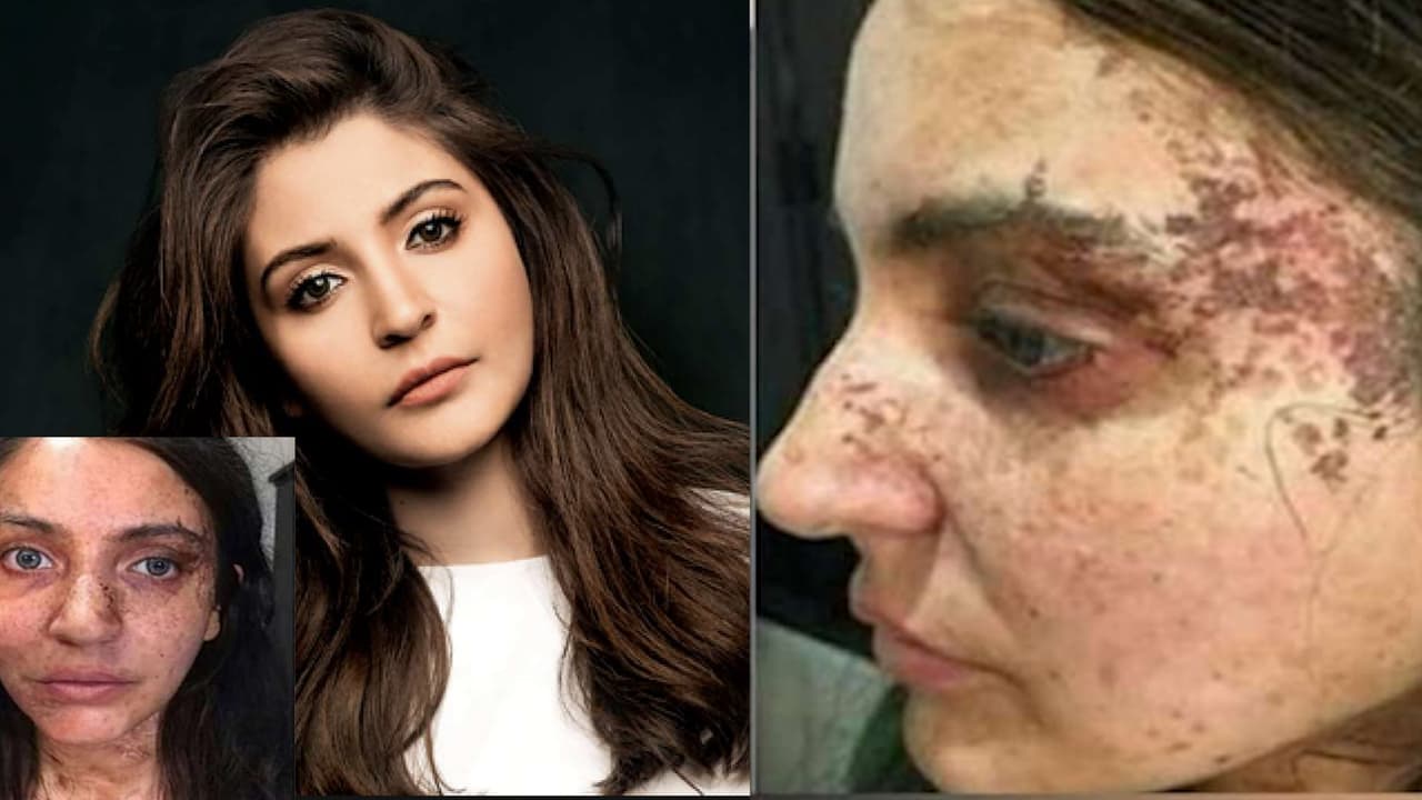 In pictures: Anushka Sharma’s ‘Pari fect’ scary looks go viral 5 months after movie's release