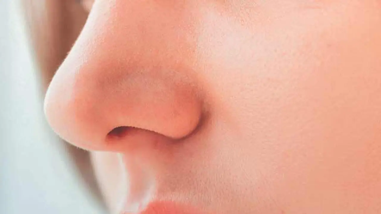 নাকের চারিদিকে ত্বক রুক্ষ্ম হয়ে যাচ্ছে? সমস্যা সমাধানে মেনে চলুন এই ঘরোয়া টোটকা নাকের চারিদিকে ত্বক রুক্ষ্ম হয়ে যাচ্ছে? সমস্যা সমাধানে মেনে চলুন এই ঘরোয়া টোটকা