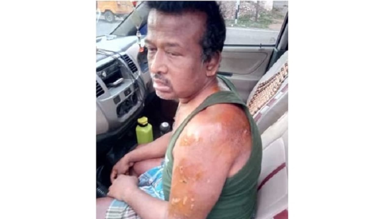 கணவரை அறையில் அடைத்து வைத்து சூடு போட்டு கொடுமை படுத்திய மனைவி! ஈரோட்டில் பரபரப்பு... கணவரை அறையில் அடைத்து வைத்து சூடு போட்டு கொடுமை படுத்திய மனைவி! ஈரோட்டில் பரபரப்பு...