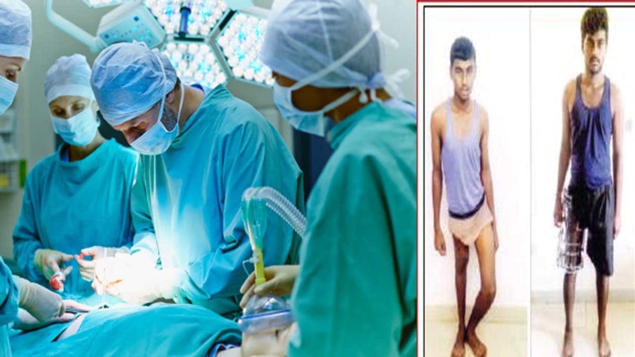 ವೈದ್ಯರ ಯಶಸ್ವಿ ಸಾಧನೆ: ಶಸ್ತ್ರ ಚಿಕಿತ್ಸೆ ನಂತರ ಬೆಳೆದ ಕಾಲು!