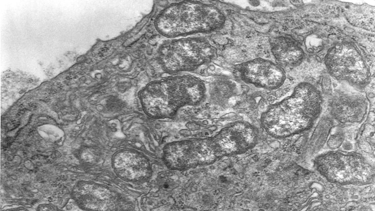 దేశంలోకి అంతుచిక్కని కొత్త వైరస్.. ఇప్పటి వరకు 15 మంది మృతి దేశంలోకి అంతుచిక్కని కొత్త వైరస్.. ఇప్పటి వరకు 15 మంది మృతి