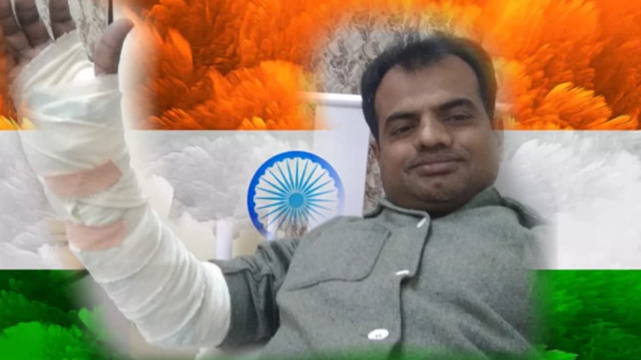 40ಕ್ಕೂ ಹೆಚ್ಚು ಹೊಲಿಗೆ ಹಾಕಿಸಿಕೊಂಡರೂ ಮನೆಗೆ ತಿಳಿಸದ ಯೋಧ..! 40ಕ್ಕೂ ಹೆಚ್ಚು ಹೊಲಿಗೆ ಹಾಕಿಸಿಕೊಂಡರೂ ಮನೆಗೆ ತಿಳಿಸದ ಯೋಧ..!