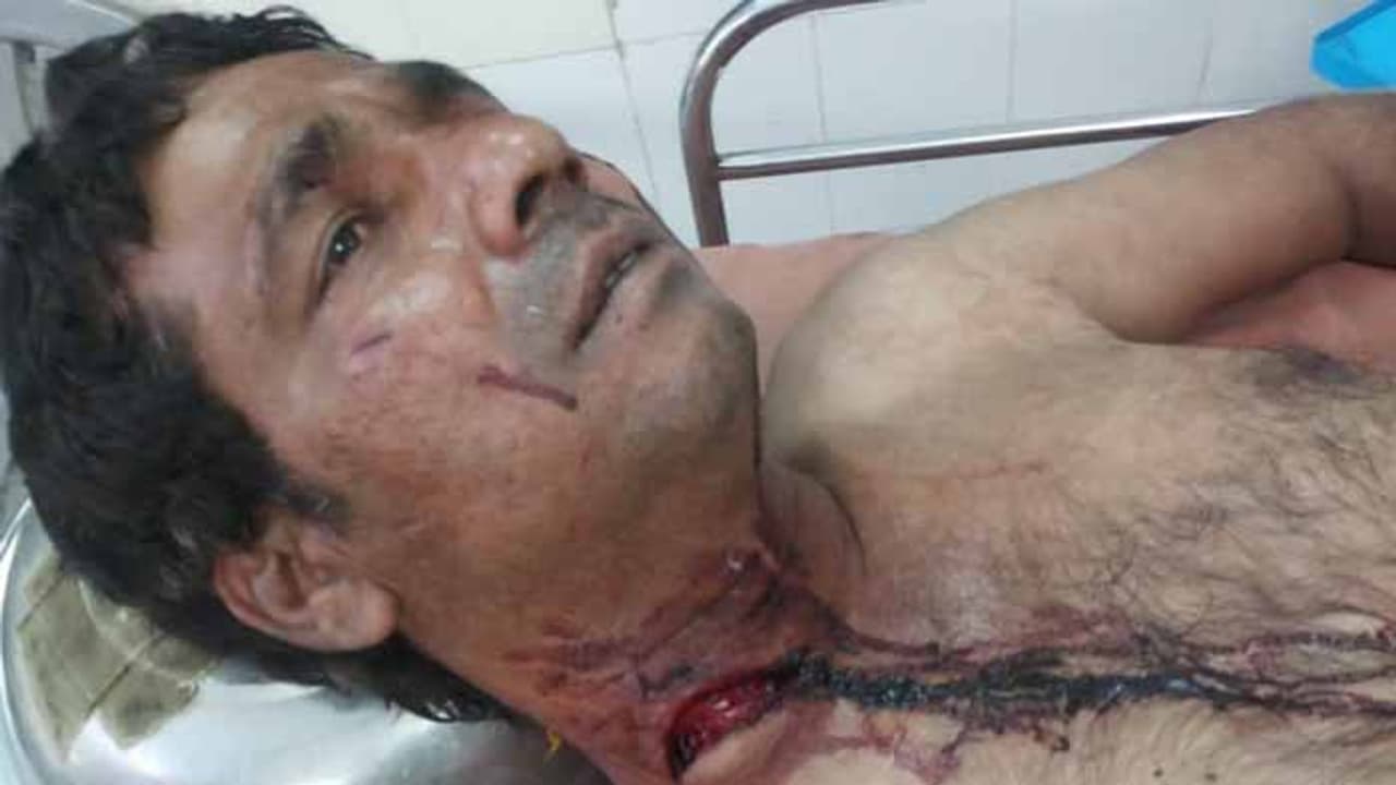 సీఎం కేసీఆర్‌కి ఫిర్యాదు చేద్దామని వచ్చి.. ఆటోడ్రైవర్ ఆత్మహత్యాయత్నం