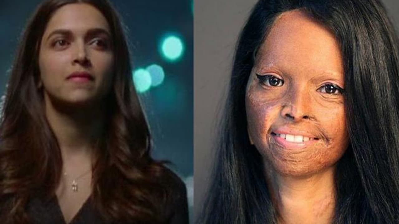 యాసిడ్ దాడికి గురైన అమ్మాయి పాత్రలో బాలీవుడ్ బ్యూటీ! యాసిడ్ దాడికి గురైన అమ్మాయి పాత్రలో బాలీవుడ్ బ్యూటీ!