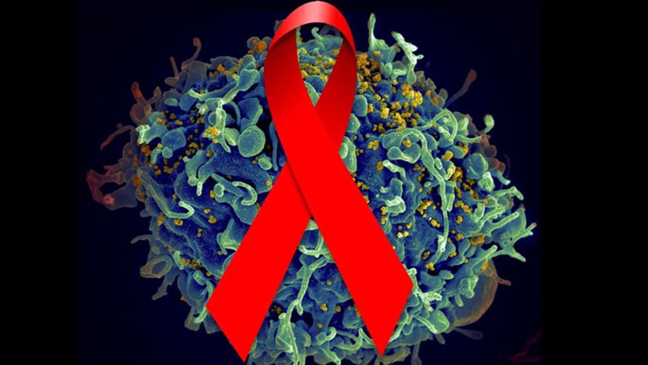 എയ്ഡ്സ് സ്ഥിരീകരിച്ചാൽ വിദേശികളെ നാടുകടത്താന് സൗദി എയ്ഡ്സ് സ്ഥിരീകരിച്ചാൽ വിദേശികളെ നാടുകടത്താന് സൗദി