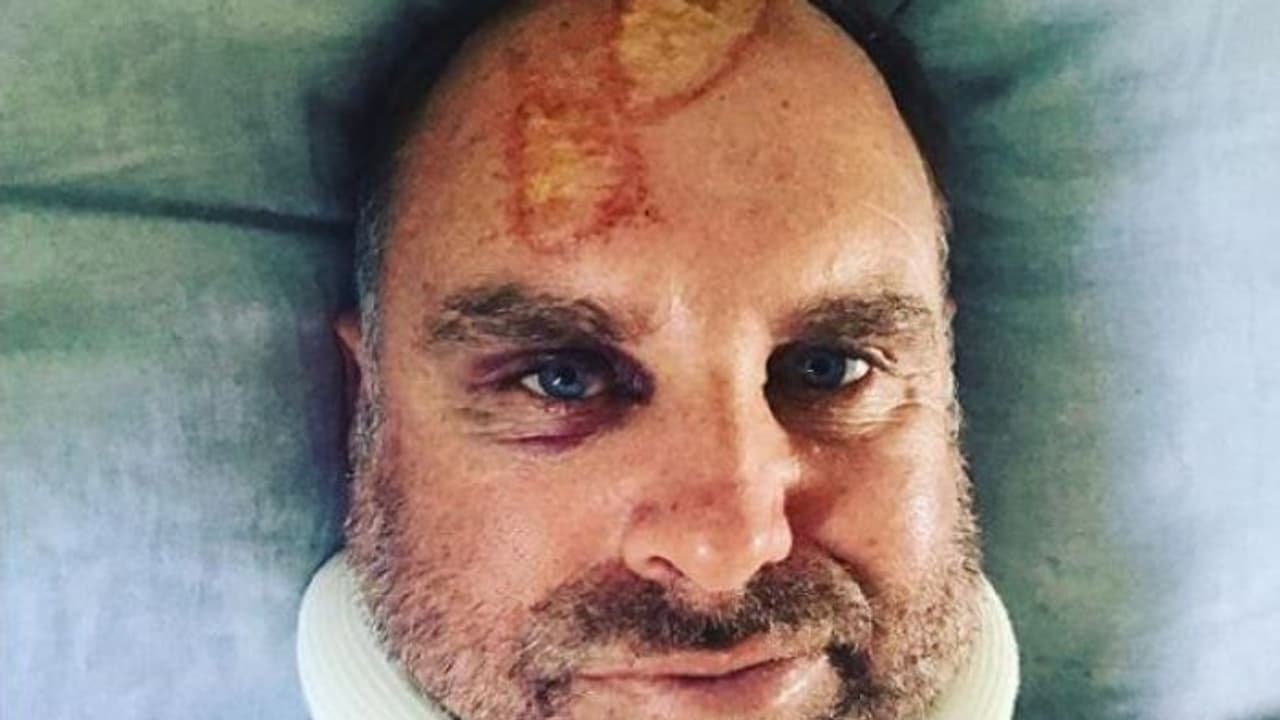 హాలిడే ట్రిప్ లో.. తీవ్రంగా గాయపడిన మాజీ క్రికెటర్ హాలిడే ట్రిప్ లో.. తీవ్రంగా గాయపడిన మాజీ క్రికెటర్