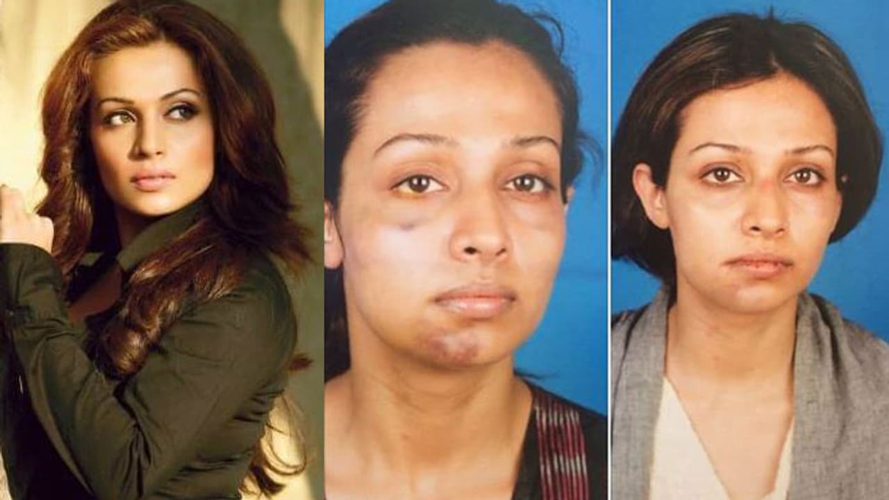 ఆ నిర్మాత దారుణంగా హింసించాడు.. నటి ఫోటోలు వైరల్! ఆ నిర్మాత దారుణంగా హింసించాడు.. నటి ఫోటోలు వైరల్!