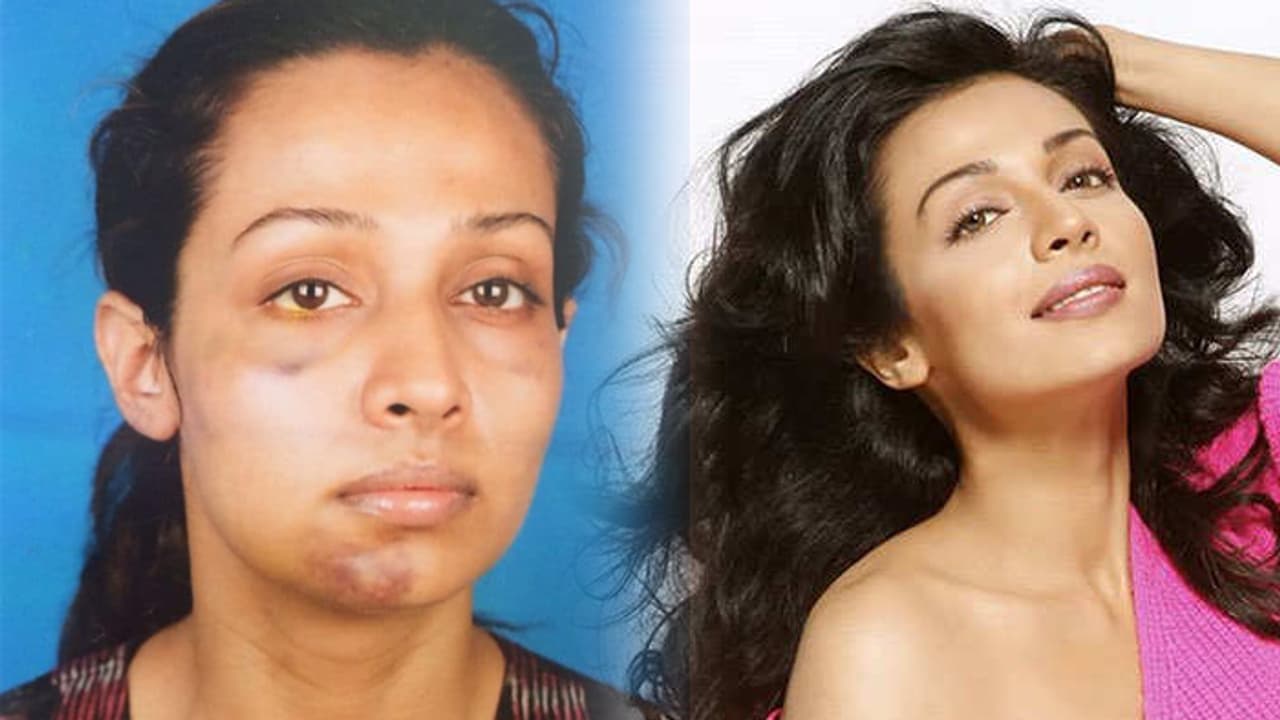 Stree actress Flora Saini shares her #MeToo story; accuses producer Gaurang Doshi of physical abuse