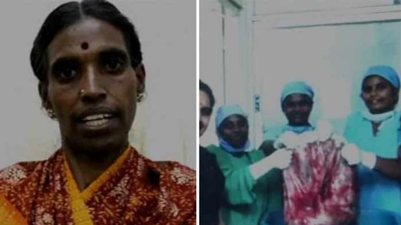 മധ്യവയസ്കയുടെ ശരീരത്തില് നിന്നും 33 കിലോ ഭാരമുള്ള മുഴ നീക്കം ചെയ്തു മധ്യവയസ്കയുടെ ശരീരത്തില് നിന്നും 33 കിലോ ഭാരമുള്ള മുഴ നീക്കം ചെയ്തു