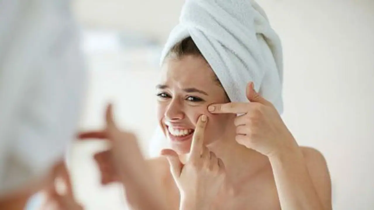 Acne Problem : ব্রণ তে ভরে গেছে সারা মুখ, রইল রাতরাতি দূর করার সহজ পদ্ধতি Acne Problem : ব্রণ তে ভরে গেছে সারা মুখ, রইল রাতরাতি দূর করার সহজ পদ্ধতি