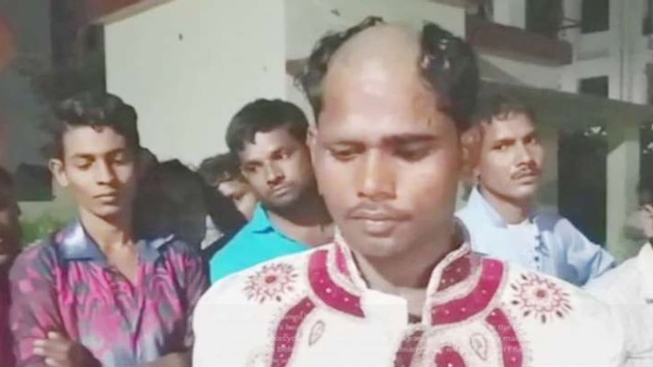 സ്ത്രീധനം കൂട്ടി ചോദിച്ചു: വരനെ തല പകുതി മൊട്ടയടിച്ച് വിട്ടു സ്ത്രീധനം കൂട്ടി ചോദിച്ചു: വരനെ തല പകുതി മൊട്ടയടിച്ച് വിട്ടു