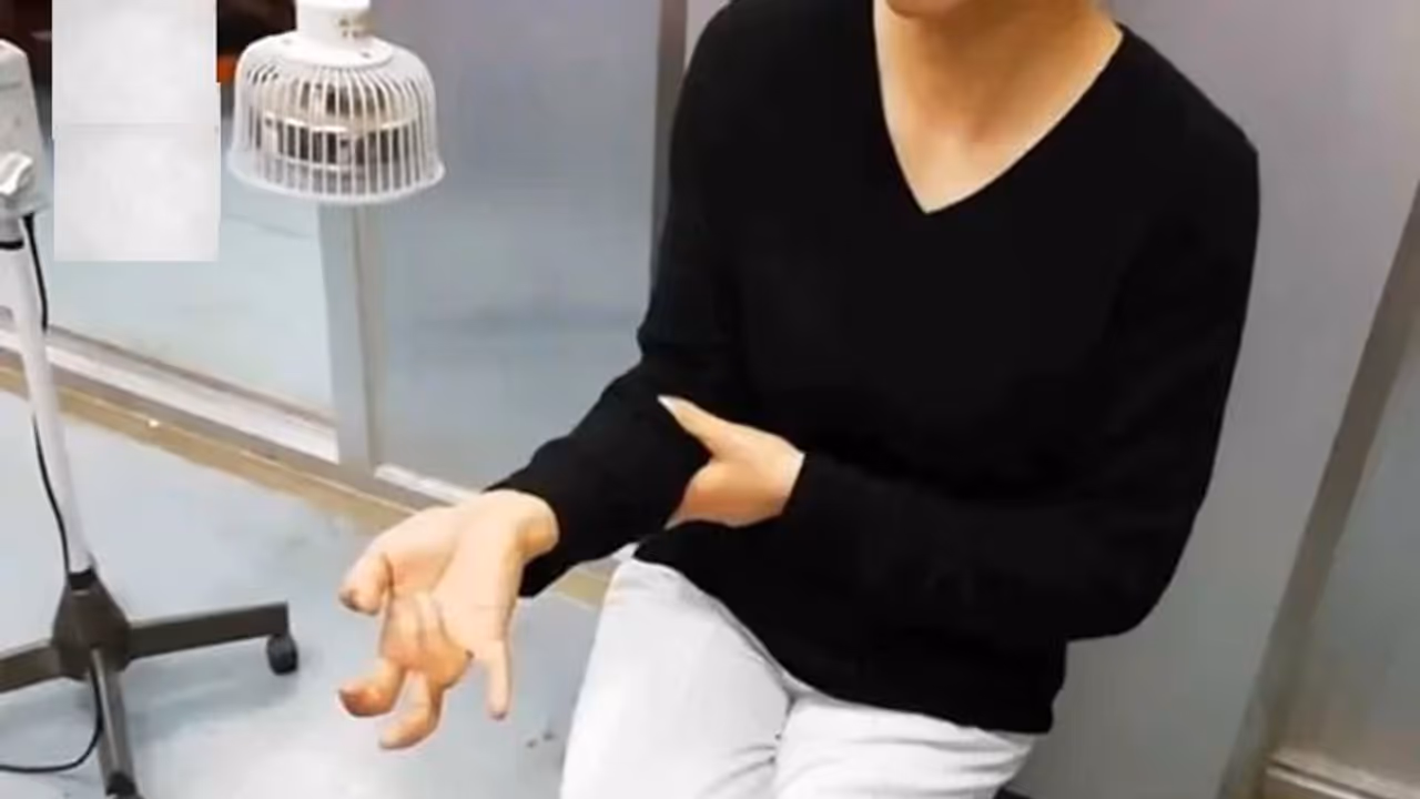 వారంపాటు కంటిన్యూస్ గా ఫోన్ వాడిన యువతి.. తర్వాత ఏమైందంటే.. వారంపాటు కంటిన్యూస్ గా ఫోన్ వాడిన యువతి.. తర్వాత ఏమైందంటే..